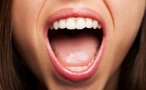 Woman with mouth wide open showing upper teeth.